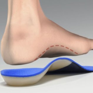 foot-in-hamilton-orthotic
